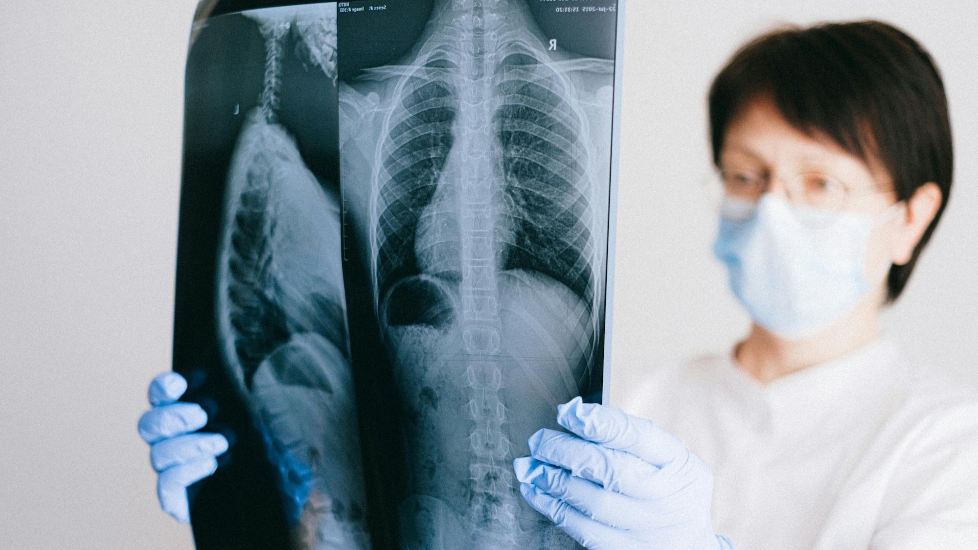 X-ray image of human spine for diagnostic purposes